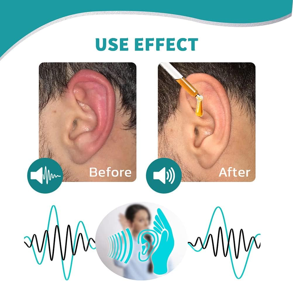 👩⚕️FDA-registriert | Juxek™ 👂Ohrentropfen – 🌿Pflanzenbasierte Formel