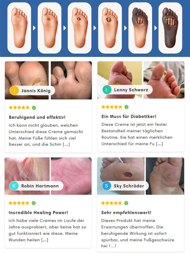 🎀50 % Rabatt auf Gesundheitsaktionen🌿Creme Zur Behandlung Von Diabetes🌿 - Verabschieden Sie sich von langsamer heilung und infektionsrisiken