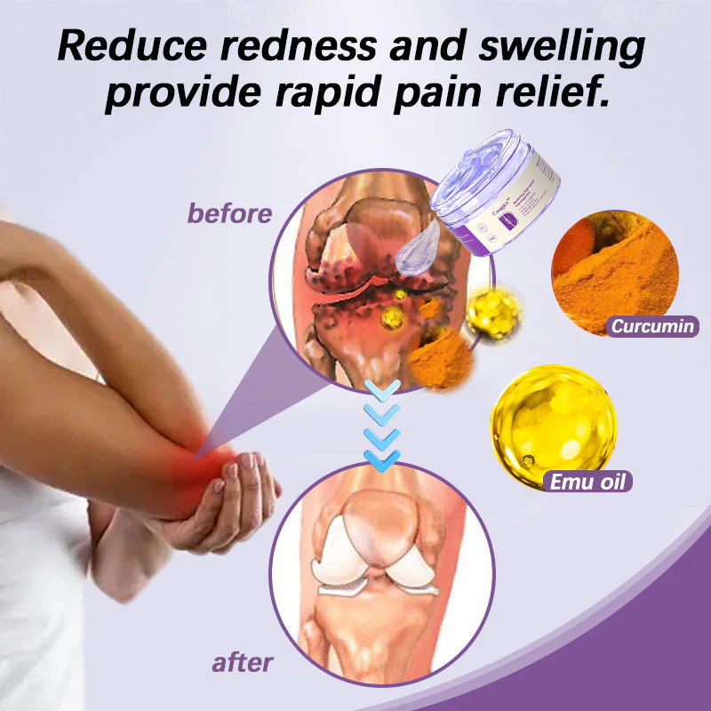 👩⚕️Turmeric & Emu Oil Arthritis Soothing Pain Relief Massage Gel 👨⚕️Australian Osteopathic Association (AOA)Approved