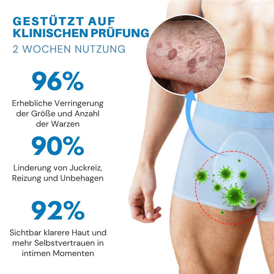 Oveallgo-SouthMoon® HPV-Creme zur Linderung genitaler Warzen