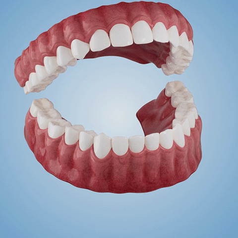 🗽 Gemäß FDA-Empfehlungen (DE) 👏 Medizinische funktionale verdickte Zahnprothesen 🦷