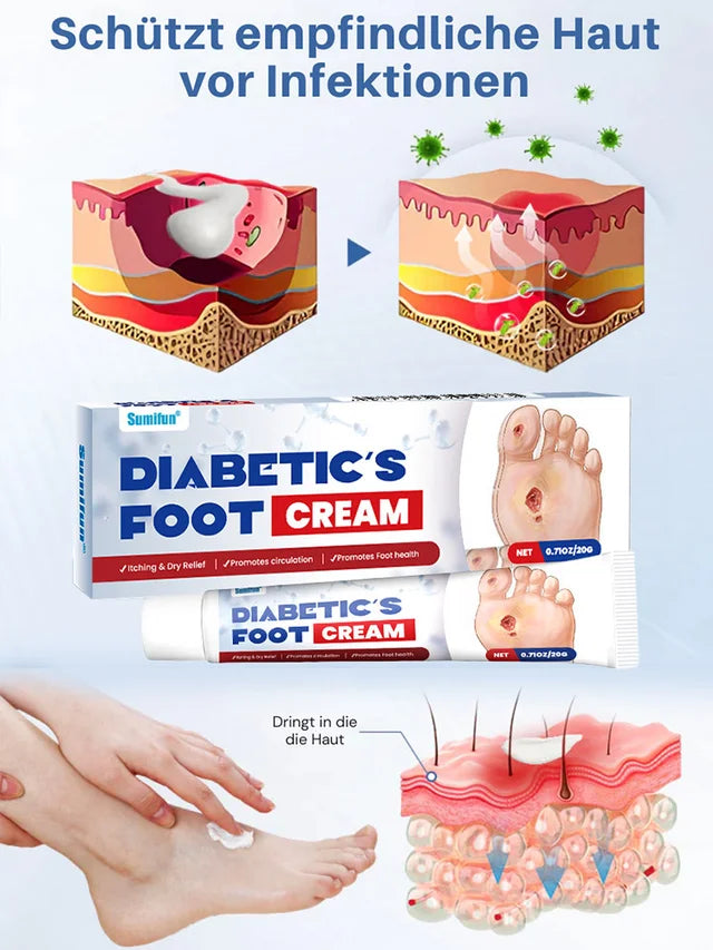 🎀50 % Rabatt auf Gesundheitsaktionen🌿Creme Zur Behandlung Von Diabetes🌿 - Verabschieden Sie sich von langsamer heilung und infektionsrisiken