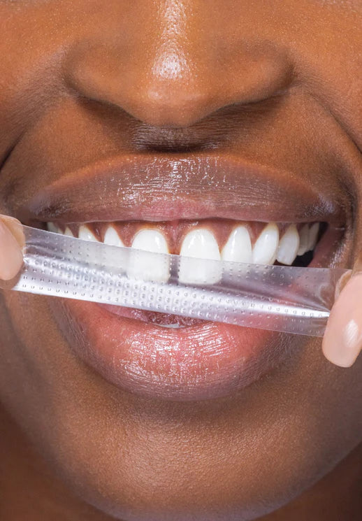 🔥Jetzt 40% Rabatt🎁PAP+ Whitening Strips – Strahlend Weiße Zähne mit Einfachen Streifen