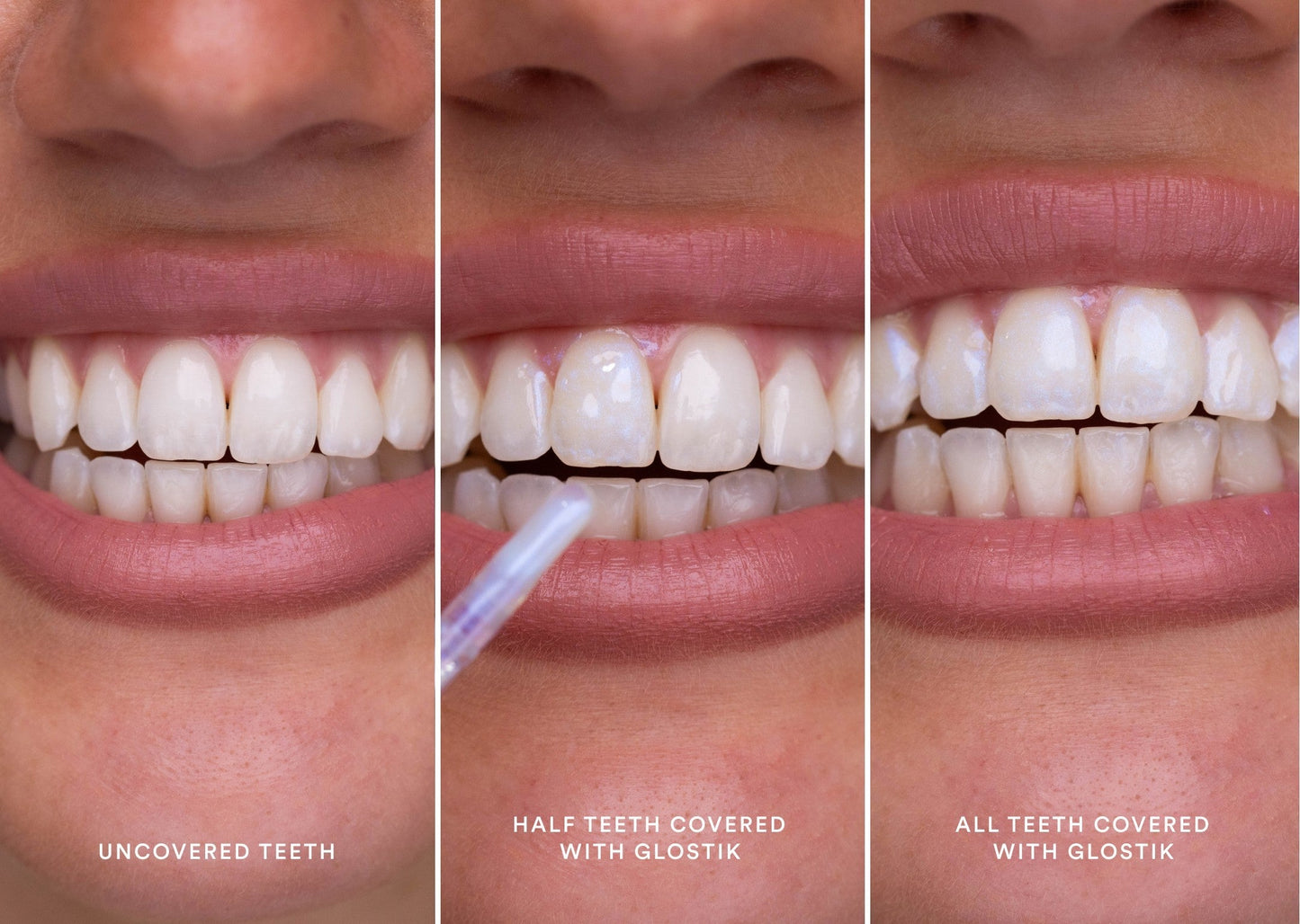 🔥Jetzt 40% Rabatt🎁 - Glostik PAP+ Reihe Tooth Gloss – 🦷Strahlend Weiße Zähne in Minuten! 🌿Natürlich & Effektiv-Perfektes Lächeln mit Glanz，Zahnglanz Revolution für Dich。