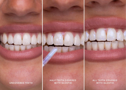 🔥Jetzt 40% Rabatt🎁 - Glostik PAP+ Reihe Tooth Gloss – 🦷Strahlend Weiße Zähne in Minuten! 🌿Natürlich & Effektiv-Perfektes Lächeln mit Glanz，Zahnglanz Revolution für Dich。