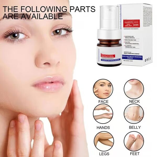 🔥Letzter Tag, 45 % Rabatt - Vitamin C Whitening Sommersprossencreme entfernt dunkle Melasma-Flecken und hellt Melanin auf
