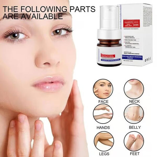 🔥Letzter Tag, 45 % Rabatt - Vitamin C Whitening Sommersprossencreme entfernt dunkle Melasma-Flecken und hellt Melanin auf