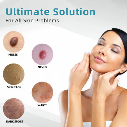 lunacipher® VelvetSkin+ All-in-One Laser Eraser Pen(Powered by CO₂ laser technology – effectively removes moles, warts, skin tags, pigmentation spots, and other skin imperfections)