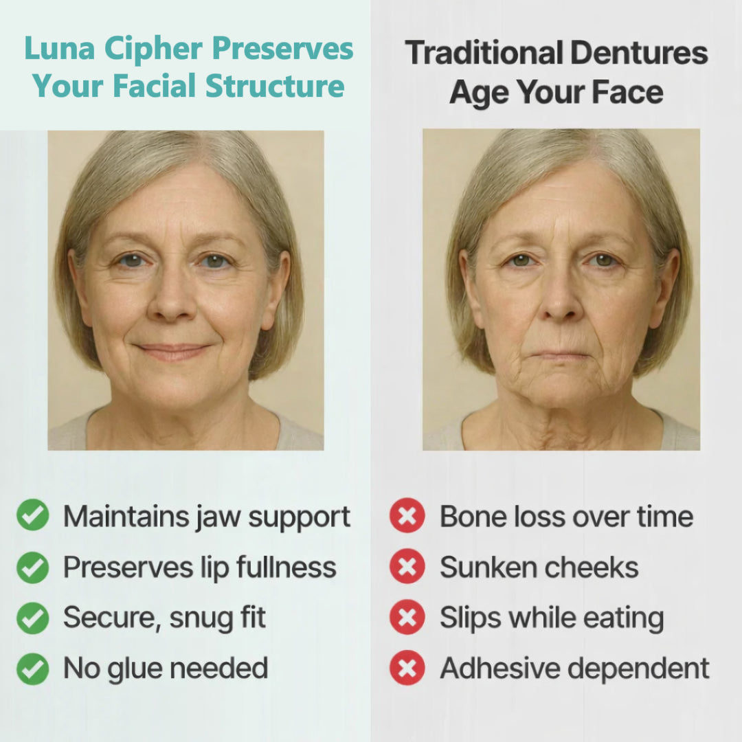 👑2026 Eaily Hot Sale Ends Today: 70% OFF! Luna Cipher Custom Custom-Fit Full Functional DenturesMake you more confident – Made in the USA & FDA-Certified
