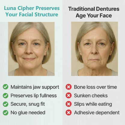 👑2026 Eaily Hot Sale Ends Today: 70% OFF! Luna Cipher Custom Custom-Fit Full Functional DenturesMake you more confident – Made in the USA & FDA-Certified