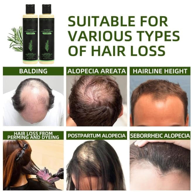 🌱 Organic Rosemary Hair Growth Shampoo