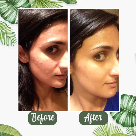 【Green Tea Pore Purifying Stick】🌿   Say goodbye to blackheads & oily pores in 3 days!