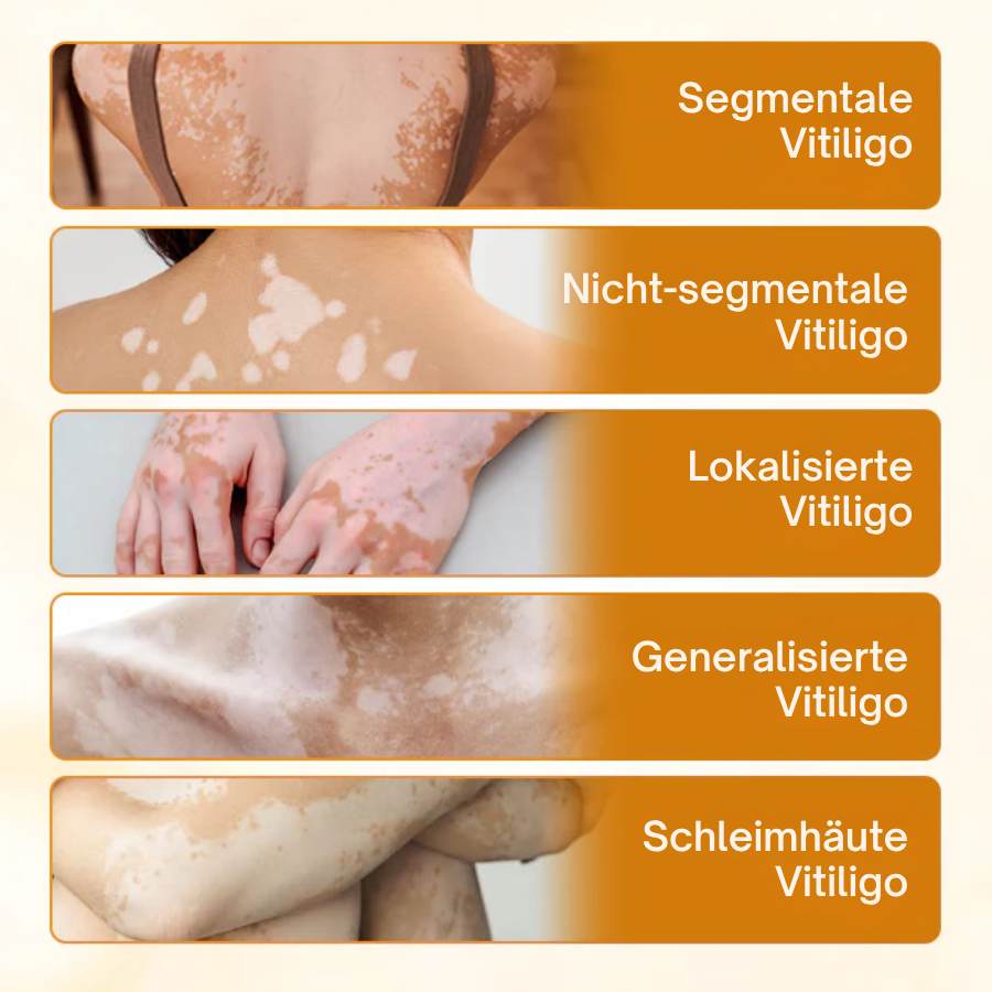 Oveallgo® VitiClear Pro Hautpflegecreme – 90% effektive Linderung bei Vitiligo