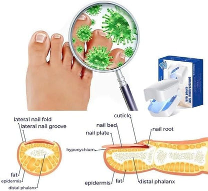 Revolutionary High Efficiency Light Therapy Device for Toenail Disease, Light Therapy Nail Fungus, Nail Cleaning and Care Device (1 Piece)