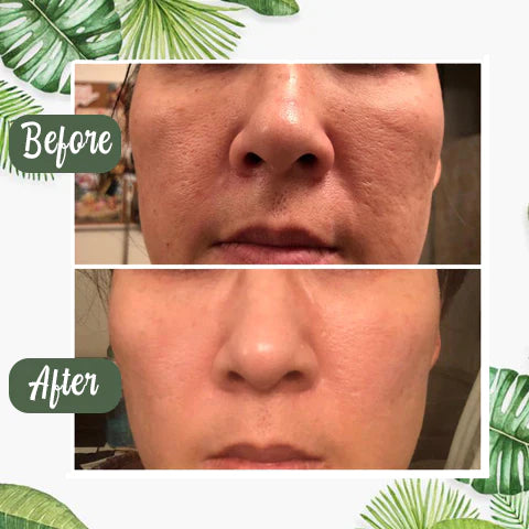 【Green Tea Pore Purifying Stick】🌿   Say goodbye to blackheads & oily pores in 3 days!