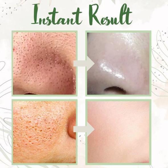 【Green Tea Pore Purifying Stick】🌿   Say goodbye to blackheads & oily pores in 3 days!