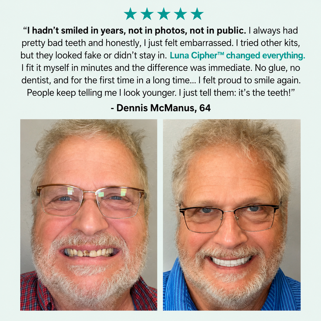 🌎Ends Today: 70% OFF! ⏰Luna Cipher™ Medical Full Denture with Strong Suctiond🦷American Dental Association(ADA) Certification✅