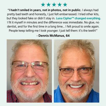 🌎Ends Today: 70% OFF! ⏰Luna Cipher™ Medical Full Denture with Strong Suctiond🦷American Dental Association(ADA) Certification✅