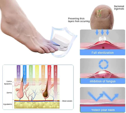 Revolutionary High Efficiency Light Therapy Device for Toenail Disease, Light Therapy Nail Fungus, Nail Cleaning and Care Device (1 Piece)