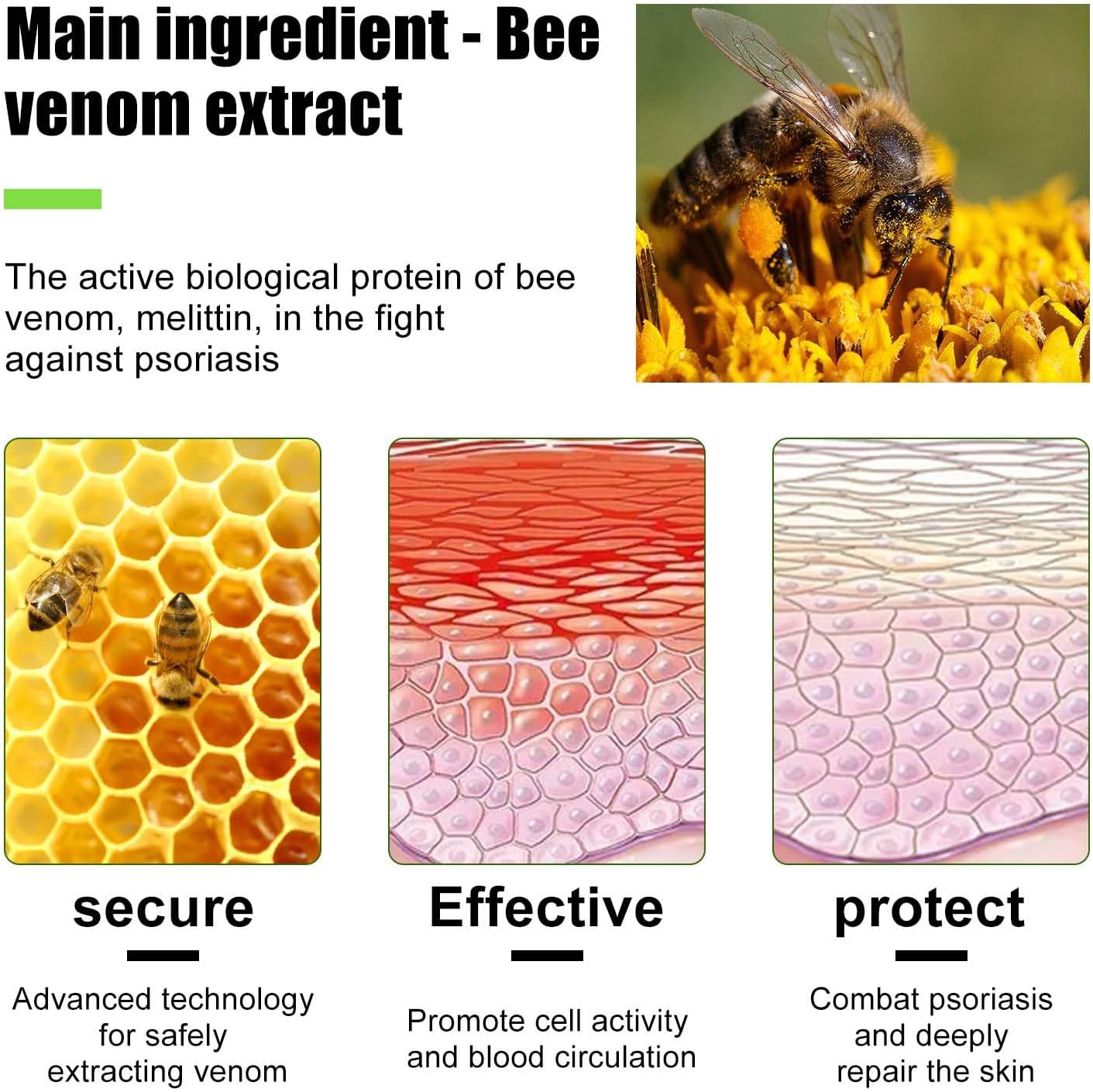 Todahof Bee Venom Psoriasis Treatment Cream, Todahof Bee Venom Psoriasis Treatment Cream, Todahof Bee Venom Cream, Psoriasis Cream, Bee Venom Psoriasis Treatment Cream (3 Pieces)