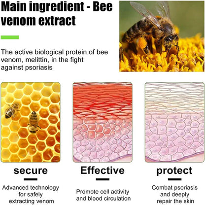 Todahof Bienengift Psoriasis Behandlungscreme, Todahof Bienengift Psoriasis Behandlungscreme, Todahof Bienengift Creme, Psoriasis Creme, Bienengift Psoriasis Behandlungscreme (3 Stück)