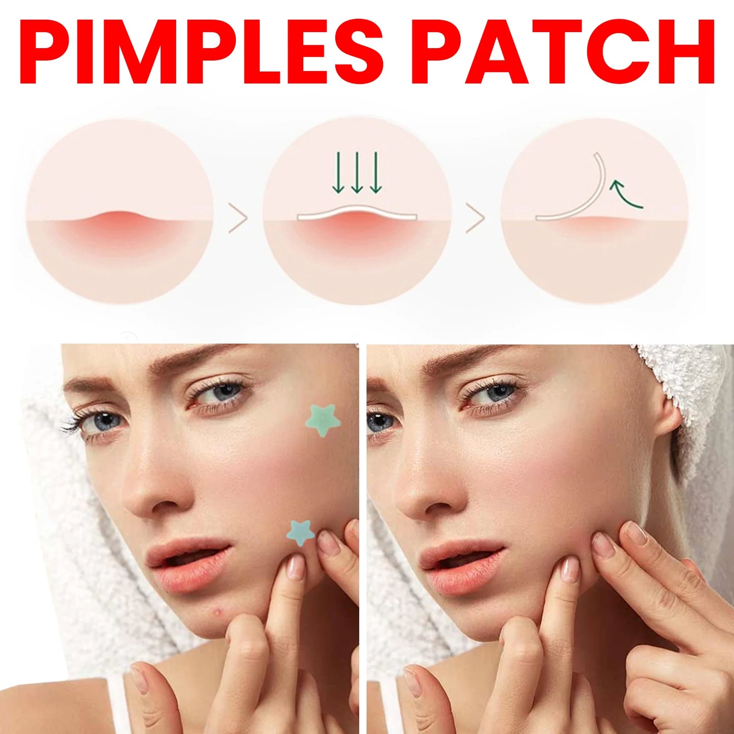 QUSTERE Pimple Patches for Face, Hydrocolloid Acne Patches