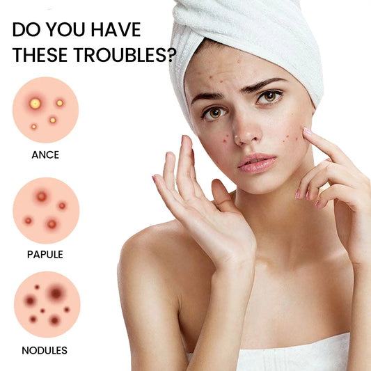 QUSTERE Pimple Patches for Face, Hydrocolloid Acne Patches