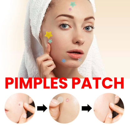 QUSTERE Pimple Patches for Face, Hydrocolloid Acne Patches