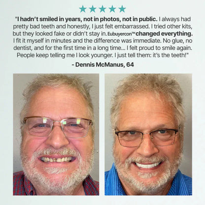 🌎Ends Today: 70% OFF! ⏰Eubuyercon™ Medical Full Denture with Strong Suctiond🦷American Dental Association(ADA) Certification✅
