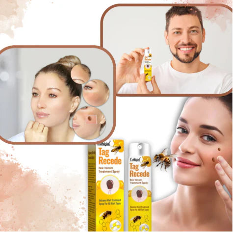 👨‍⚕️ILDS-Recommend 🟢 🐝TagRecede Bee venom Anti-Wart and Skin Treatment Spray💨