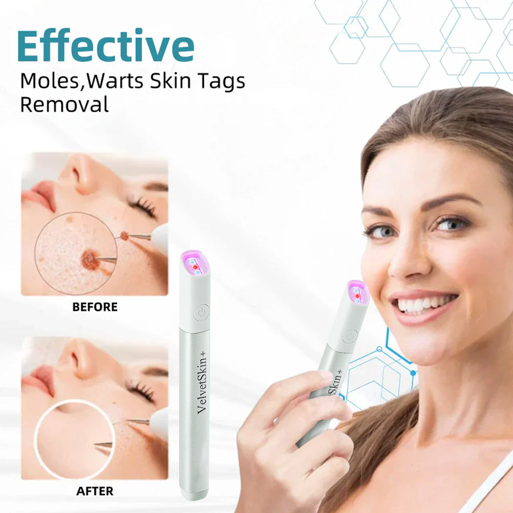 lunacipher® VelvetSkin+ All-in-One Laser Eraser Pen(Powered by CO₂ laser technology – effectively removes moles, warts, skin tags, pigmentation spots, and other skin imperfections)