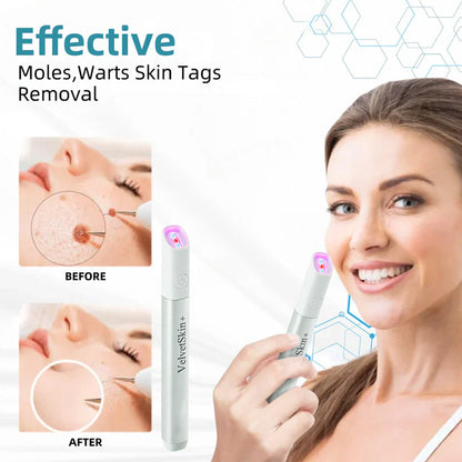 lunacipher® VelvetSkin+ All-in-One Laser Eraser Pen(Powered by CO₂ laser technology – effectively removes moles, warts, skin tags, pigmentation spots, and other skin imperfections)