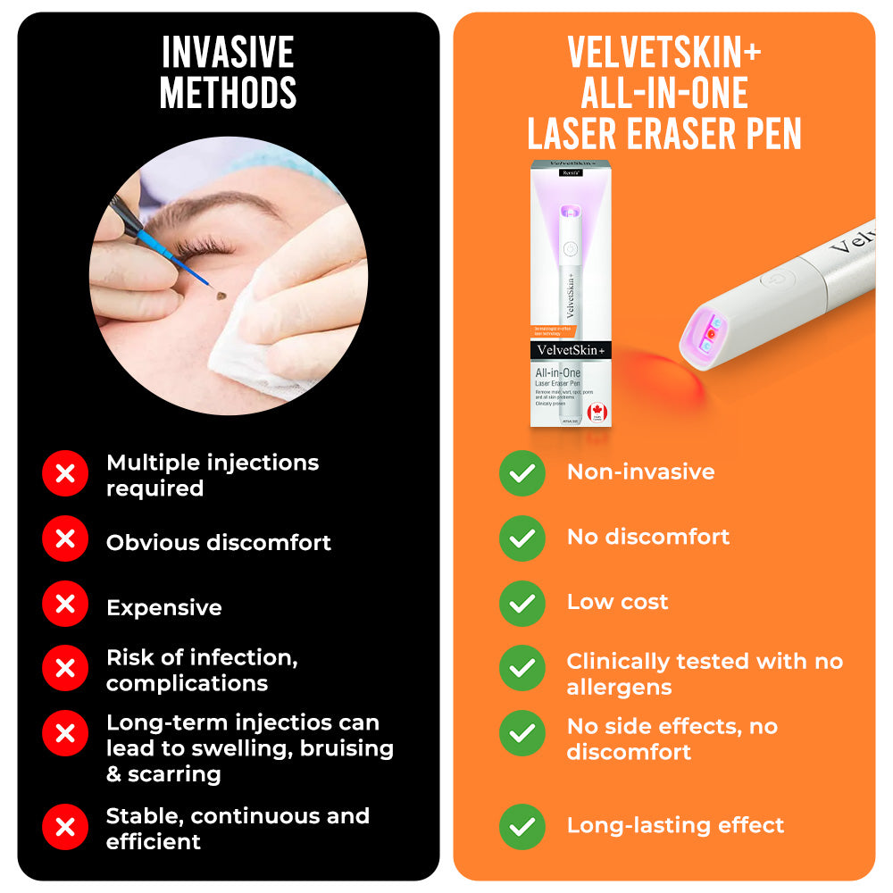 lunacipher® VelvetSkin+ All-in-One Laser Eraser Pen(Powered by CO₂ laser technology – effectively removes moles, warts, skin tags, pigmentation spots, and other skin imperfections)