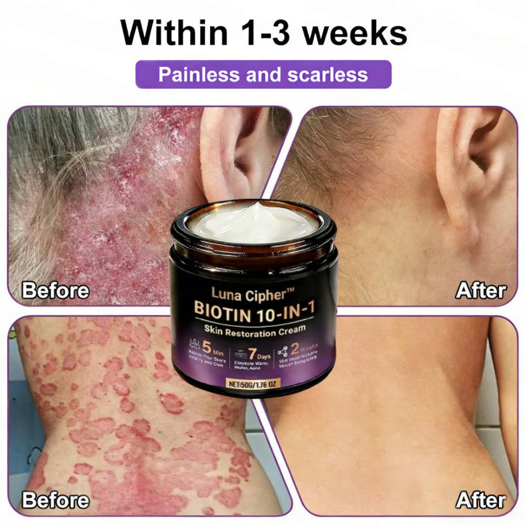 Made and Shipped from USA ✨Luna Cipher™ Biotin 10-in-1 Skin Restoration Cream 🍀