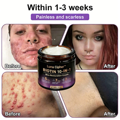 Made and Shipped from USA ✨Luna Cipher™ Biotin 10-in-1 Skin Restoration Cream 🍀