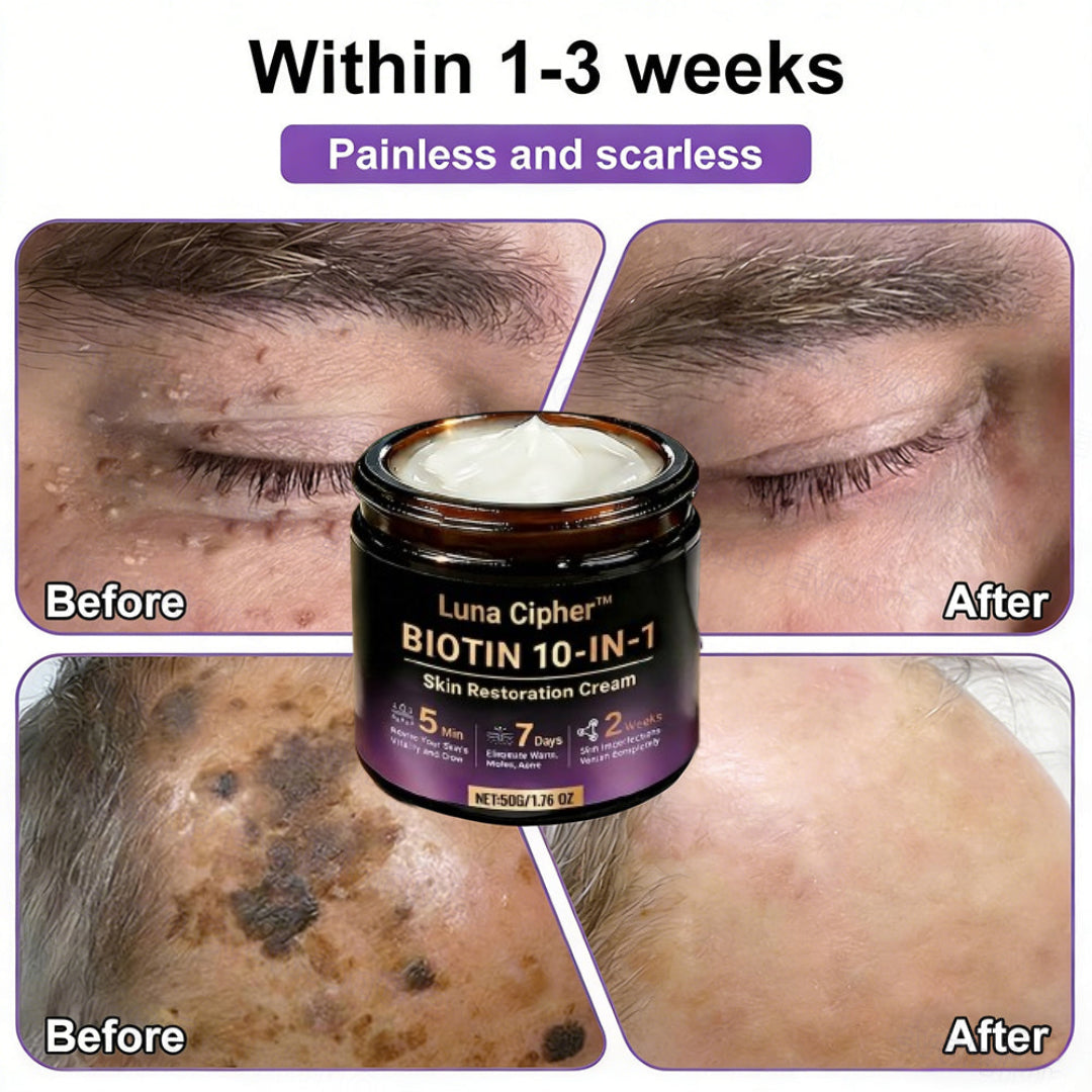 Made and Shipped from USA ✨Luna Cipher™ Biotin 10-in-1 Skin Restoration Cream 🍀