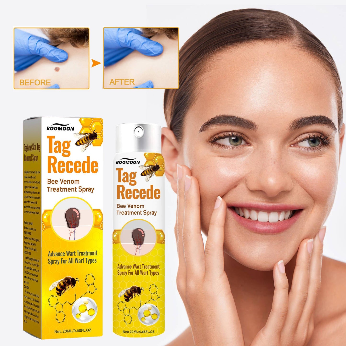 👨‍⚕️ILDS-Recommend 🟢 🐝TagRecede Bee venom Anti-Wart and Skin Treatment Spray💨