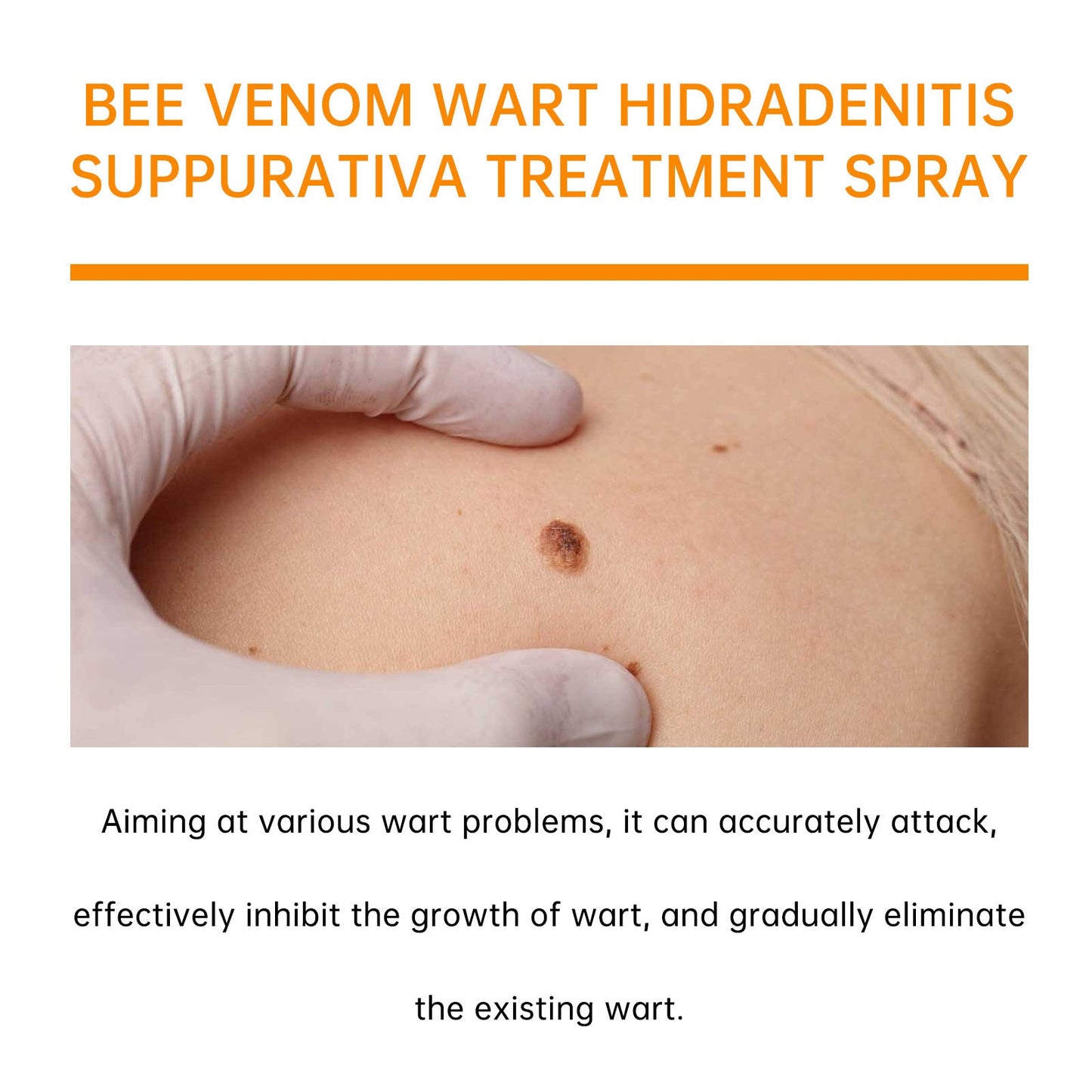 👨‍⚕️ILDS-Recommend 🟢 🐝TagRecede Bee venom Anti-Wart and Skin Treatment Spray💨